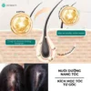 [COMBO] Serum dưỡng nang tóc & da đầu Bio-placental và Viên uống Phyto giúp giảm rụng tóc, hỗ trợ mọc tóc