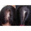 [COMBO] Serum dưỡng nang tóc & da đầu Bio-placental và Viên uống Phyto giúp giảm rụng tóc, hỗ trợ mọc tóc